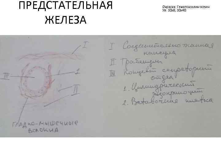 ПРЕДСТАТЕЛЬНАЯ ЖЕЛЕЗА Окраска: Гематоксилин-эозин Ув: 10 х8; 10 х40 