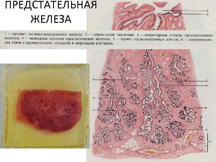 ПРЕДСТАТЕЛЬНАЯ ЖЕЛЕЗА 