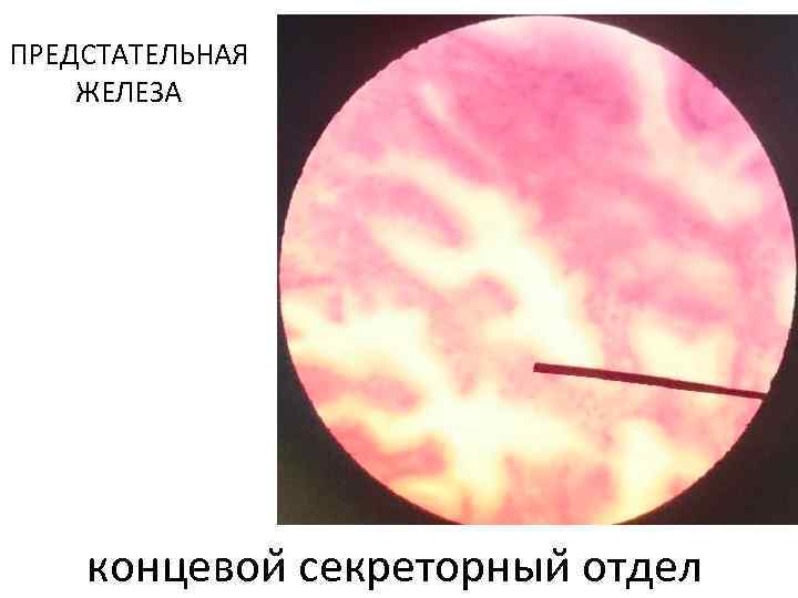 ПРЕДСТАТЕЛЬНАЯ ЖЕЛЕЗА концевои секреторныи отдел 