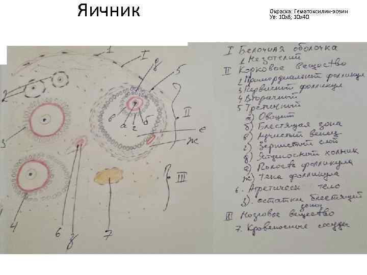 Яичник Окраска: Гематоксилин-эозин Ув: 10 х8; 10 х40 