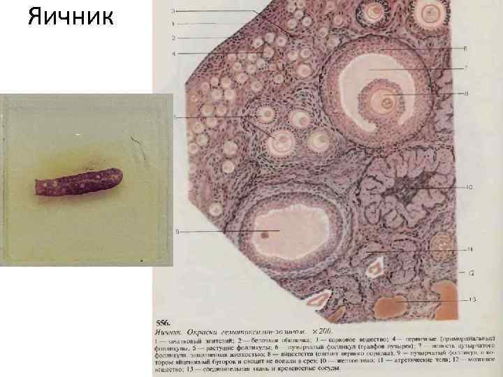 Яичник 
