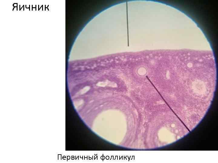 Яичник Первичный фолликул 