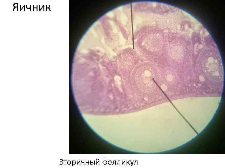 Яичник Вторичный фолликул 