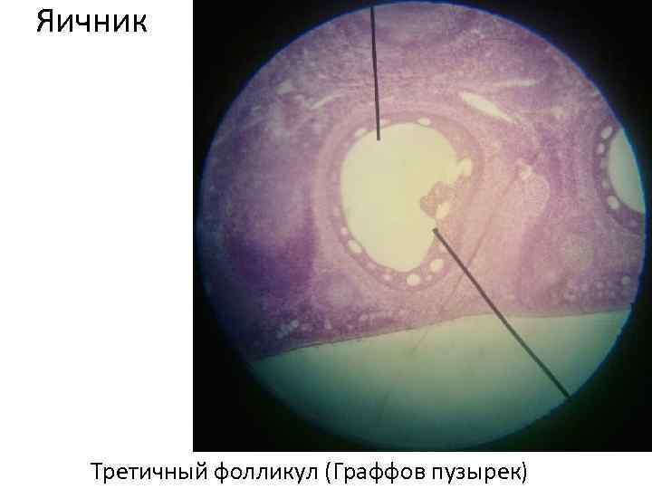 Яичник Третичный фолликул (Граффов пузырек) 