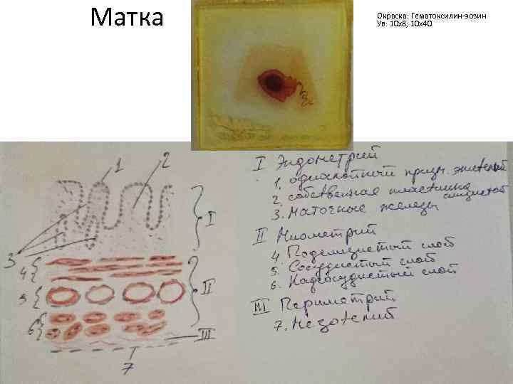 Матка Окраска: Гематоксилин-эозин Ув: 10 х8; 10 х40 