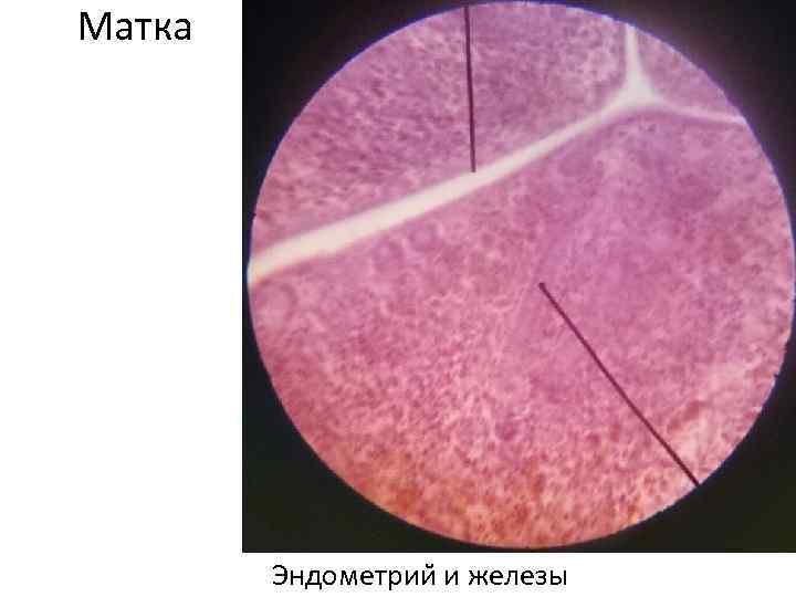 Матка Эндометрии и железы 