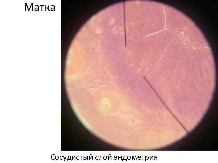 Матка Сосудистыи слои эндометрия 