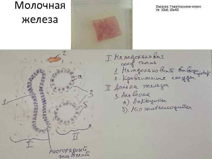 Молочная железа Окраска: Гематоксилин-эозин Ув: 10 х8; 10 х40 