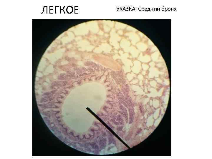 ЛЕГКОЕ УКАЗКА: Средний бронх 