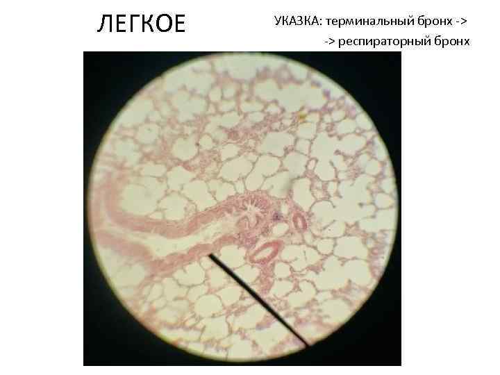 ЛЕГКОЕ УКАЗКА: терминальный бронх -> -> респираторный бронх 