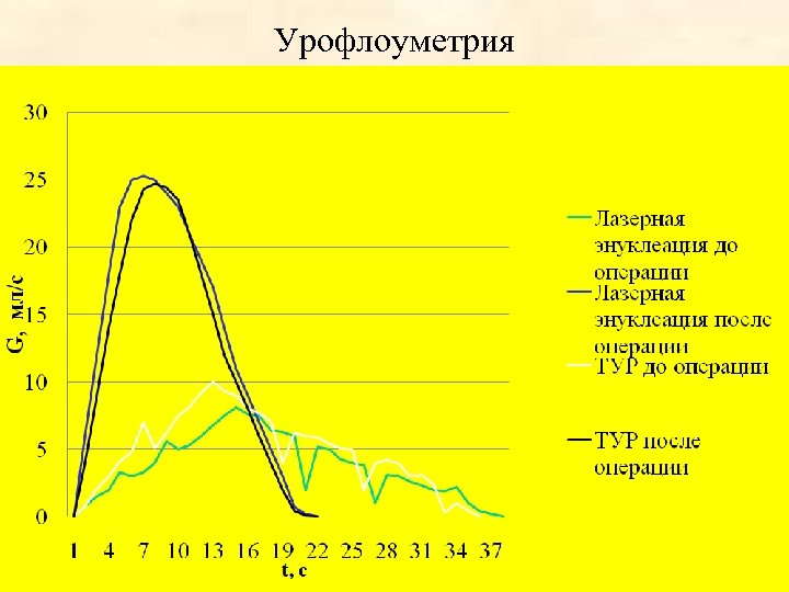 Что такое урофлоуметрия. Урофлоуметрия. Урофлоуметрия типы. Показатели урофлоуметрии в норме. Урофлоуметрия нормальные показатели у мужчин.