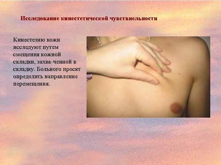 Исследование кинестетической чувствиельности Кинестезию кожи исследуют путем смещения кожной складки, захва ченной в складку.