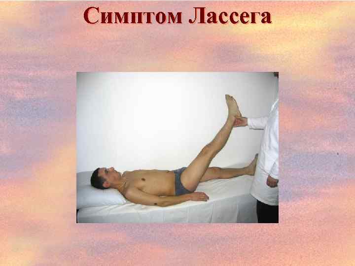 Симптом Лассега 