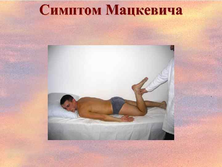 Симптом Мацкевича 