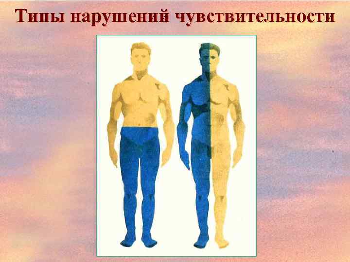 Типы нарушений чувствительности 