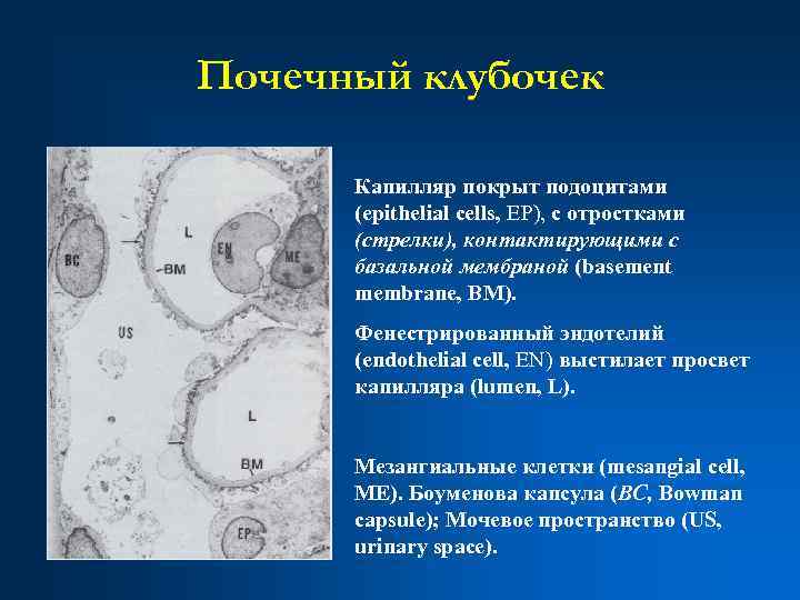 Почечный клубочек Капилляр покрыт подоцитами (epithelial cells, EP), с отростками (стрелки), контактирующими с базальной