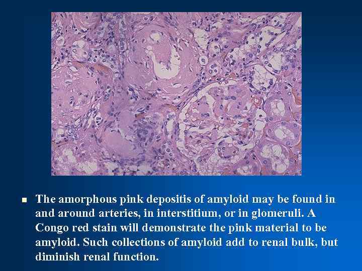 n The amorphous pink depositis of amyloid may be found in and around arteries,