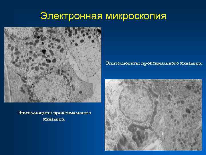 Электронная микроскопия Эпителиоциты проксимального канальца. 