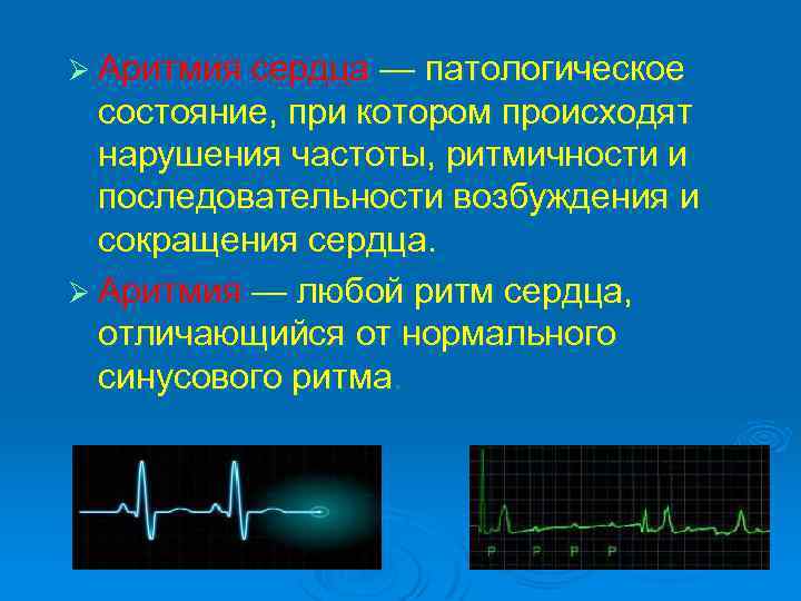 Нарушение частоты