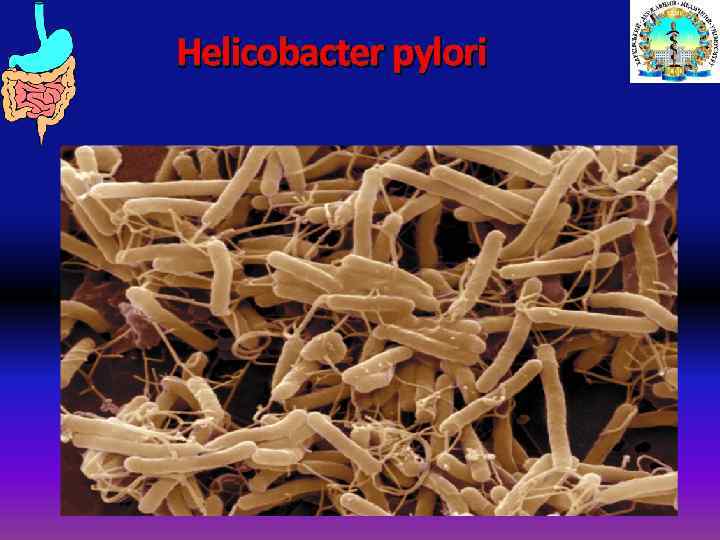 Helicobacter pylori 