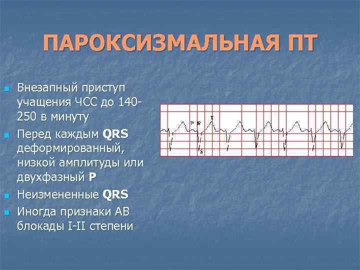 ПАРОКСИЗМАЛЬНАЯ ПТ n n Внезапный приступ учащения ЧСС до 140250 в минуту Перед каждым