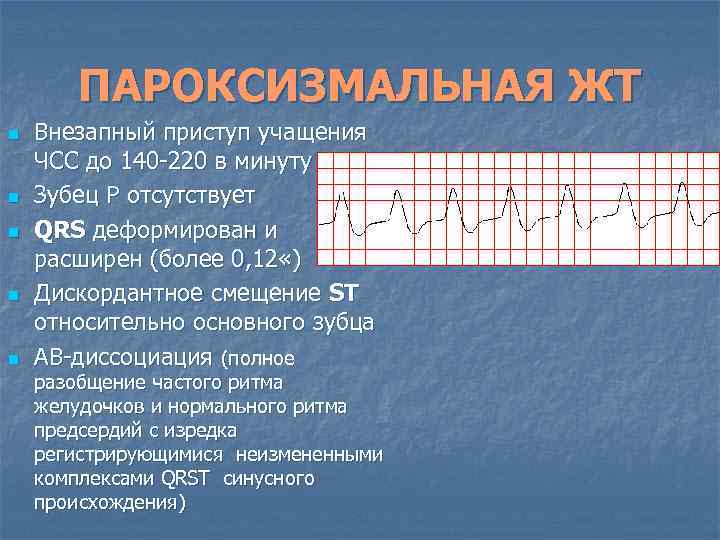 ПАРОКСИЗМАЛЬНАЯ ЖТ n n n Внезапный приступ учащения ЧСС до 140 -220 в минуту