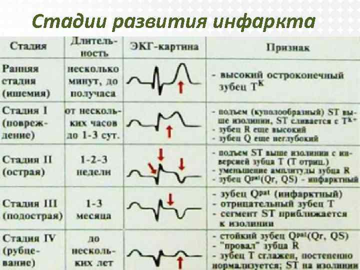 План ухода за пациентом при инфаркте миокарда