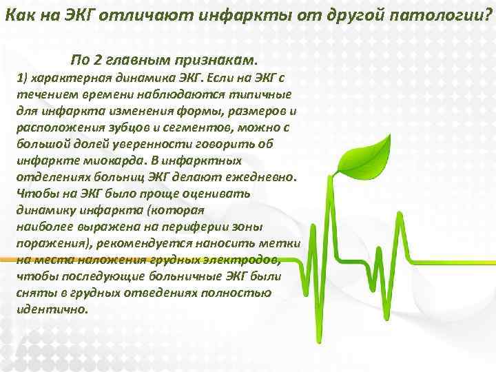 Как на ЭКГ отличают инфаркты от другой патологии? По 2 главным признакам. 1) характерная