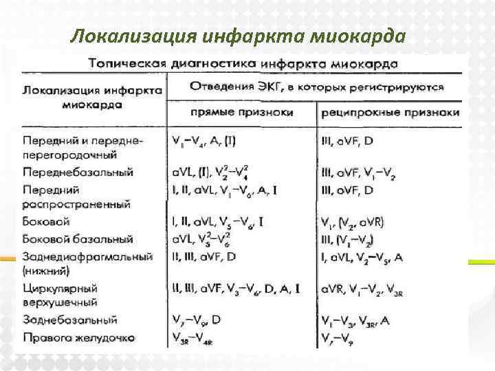 Локализация инфаркта миокарда 