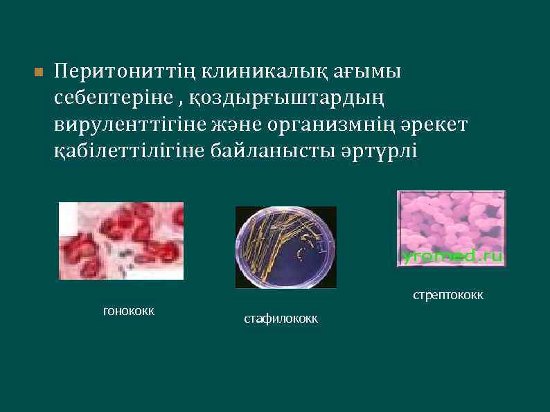 n Перитониттің клиникалық ағымы себептеріне , қоздырғыштардың вируленттігіне және организмнің әрекет қабілеттілігіне байланысты әртүрлі