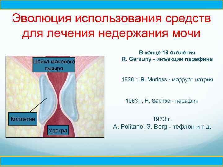 Ч Эволюция использования средств для лечения недержания мочи В конце 19 столетия R. Gersuny