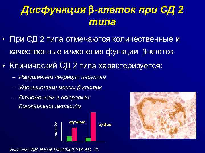 Дисфункция -клеток при СД 2 типа • При СД 2 типа отмечаются количественные и