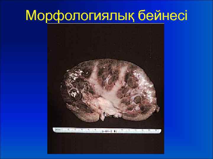 Морфологиялық бейнесі 