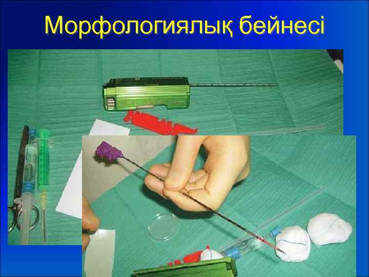 Морфологиялық бейнесі 