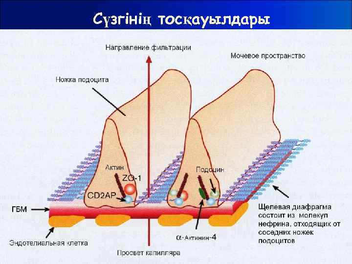 Сүзгінің тосқауылдары 