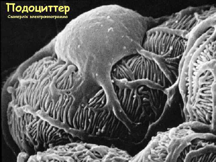Подоциттер Сканерлік электроннограмма 
