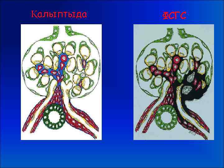 Қалыптыда ФСГС 