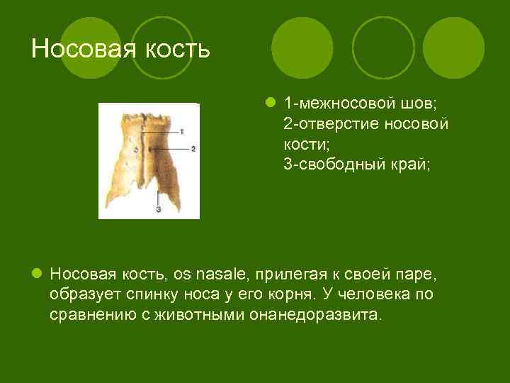 Носовая кость l 1 -межносовой шов; 2 -отверстие носовой кости; 3 -свободный край; l