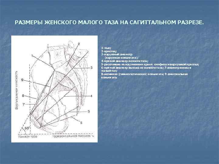 РАЗМЕРЫ ЖЕНСКОГО МАЛОГО ТАЗА НА САГИТТАЛЬНОМ РАЗРЕЗЕ. 1 -мыс; 2 -крестец; 3 -наружный диаметр