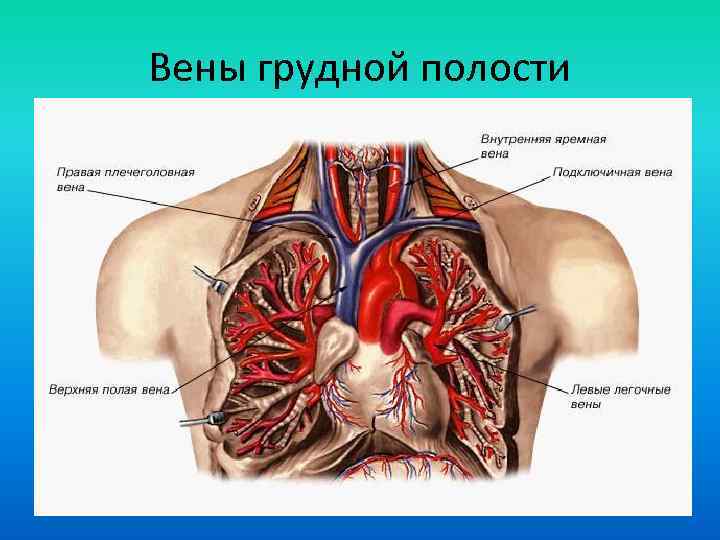 Синдром верхней полой вены