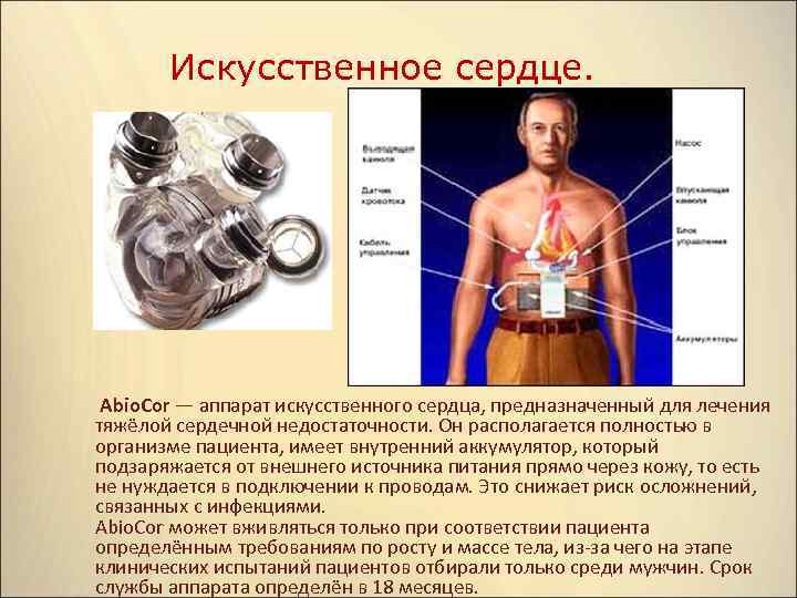 Искусственное сердце abiocor презентация