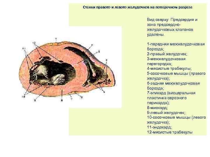 Стенки правого желудочка. Правый желудочек в разрезе. Стенки правого и левого желудочков. Толщина стенки правого желудочка. Стенки левого желудочка.