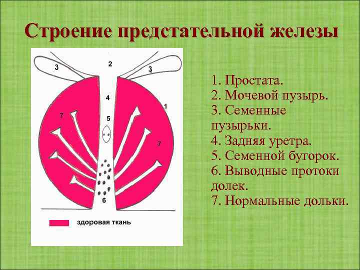 Строение предстательной железы 1. Простата. 2. Мочевой пузырь. 3. Семенные пузырьки. 4. Задняя уретра.