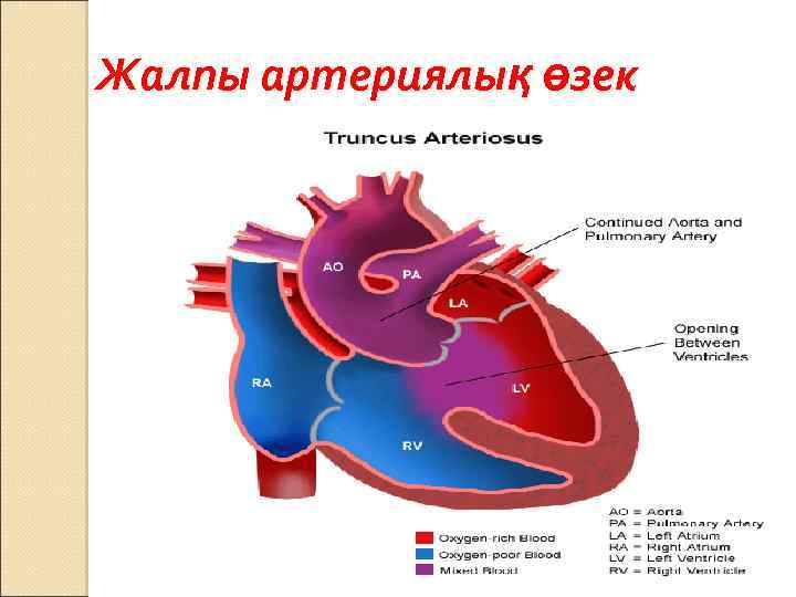 Жалпы артериялық өзек 