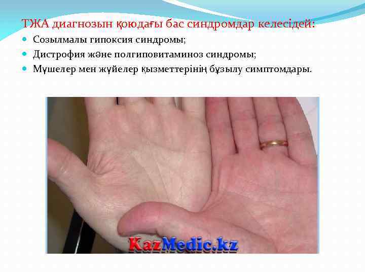 ТЖА диагнозын қоюдағы бас синдромдар келесідей: Созылмалы гипоксия синдромы; Дистрофия және полгиповитаминоз синдромы; Мүшелер