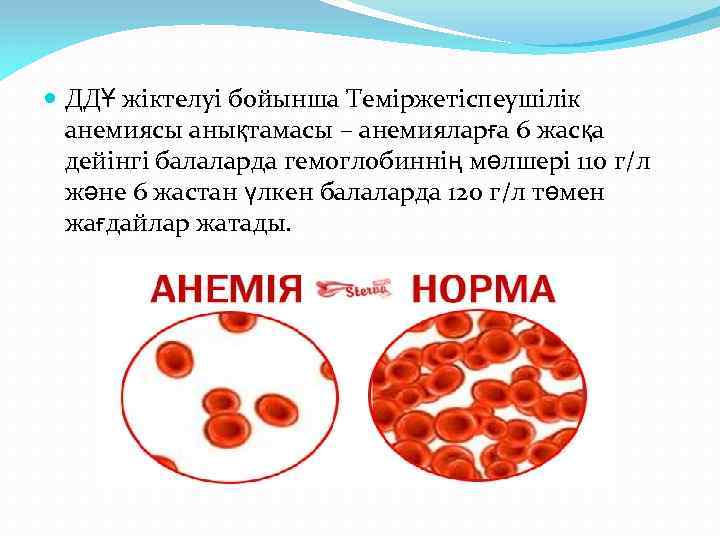  ДДҰ жіктелуі бойынша Теміржетіспеушілік анемиясы анықтамасы – анемияларға 6 жасқа дейінгі балаларда гемоглобиннің