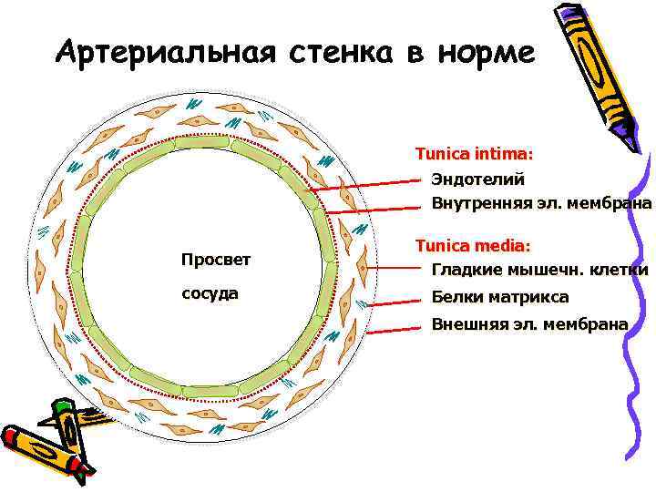 Артериальная стенка в норме Tunica intima: Эндотелий Внутренняя эл. мембрана Просвет сосуда Tunica media: