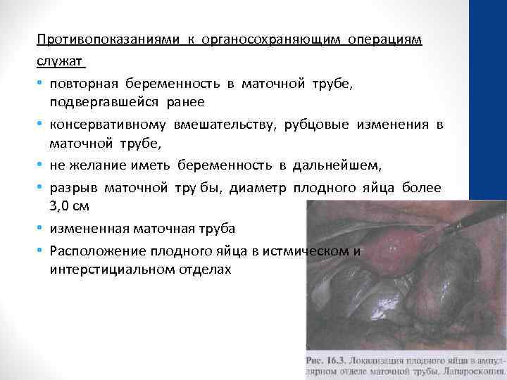 Противопоказаниями к органосохраняющим операциям служат • повторная беременность в маточной трубе, подвергавшейся ранее •
