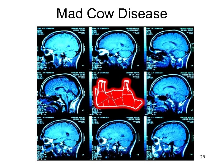 Mad Cow Disease 26 