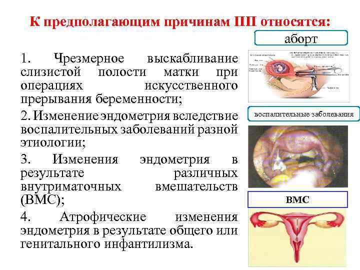 К предполагающим причинам ПП относятся: аборт 1. Чрезмерное выскабливание слизистой полости матки при операциях